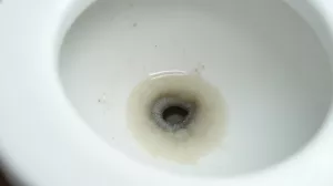 Kamień w WC poniżej linii wody