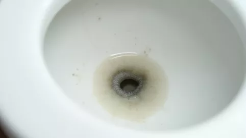 Kamień w WC poniżej linii wody